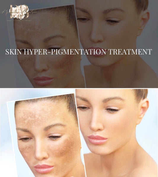 Hyper-Pigmentation Treatments Breanna’s Boutique 