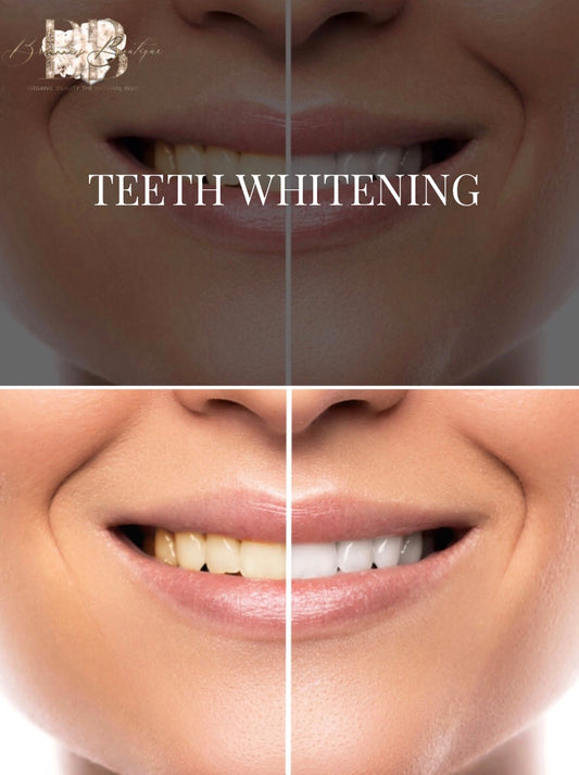 Teeth Whitening Breanna’s Boutique 